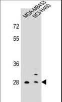 FBP / FOLR2 Antibody (aa17-44)