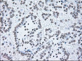 BRAF / B-Raf Antibody (clone OTI4C11)