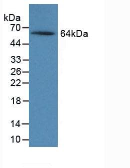Rat NOG / Noggin Protein (Native His-MBP, N-terminus)
