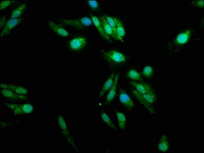 IHC-plus™ PAD2 / PADI2 Antibody (aa1-665)