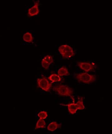 ZDHHC15 Antibody