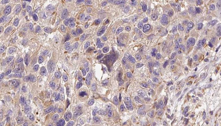 Polyclonal Rabbit anti-Human GPX7 Antibody (IHC, WB)