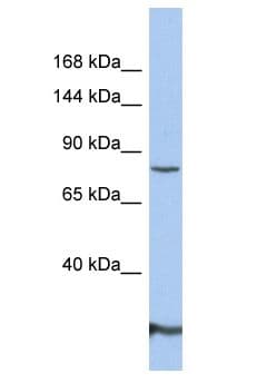 GRIA2 / GLUR2 Antibody (aa195-244)