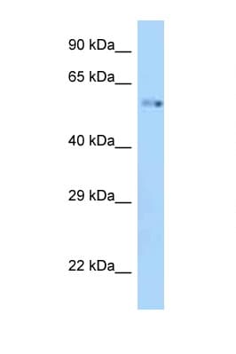 ZIK1 Antibody (aa318-367)