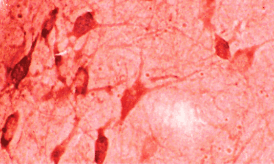 HMOX1 / HO-1 Antibody (Biotin)