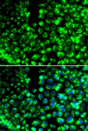 CALU / Calumenin Antibody