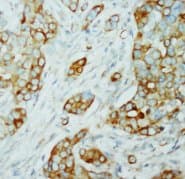 AKT1 + AKT2 Antibody (N-Terminus)