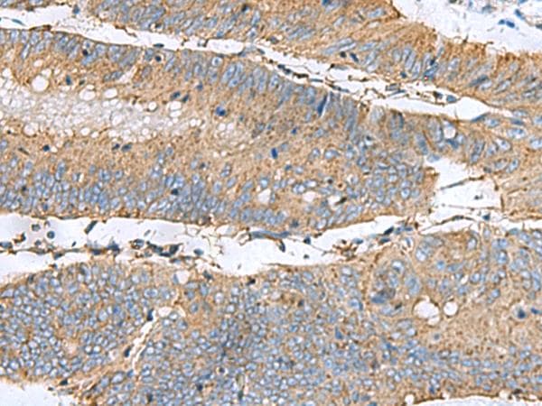 CLTB Antibody