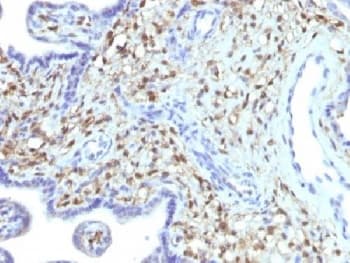 S100A4 / FSP1 Antibody (clone S100A4/1481)