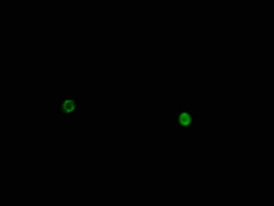 Polyclonal Rabbit anti-Human HIST1H1E Antibody (phospho-Thr146, WB)