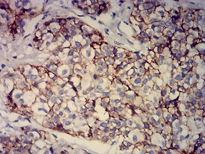 BCAM / CD239 Antibody (clone 8C4E6)