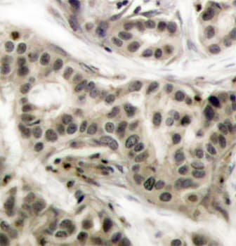 NFKB1 / NF-Kappa-B Antibody (phospho-Ser337)