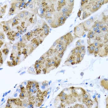 IHC-plus™ MGP / Matrix Gla-Protein Antibody