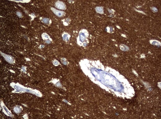 NCAM / CD56 Antibody (aa20-718, clone UMAB83, Carrier-free)
