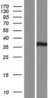 HOMER3 / Homer 3 Protein (Over-Expression Lysate Myc-DDK (Flag))