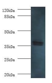 Polyclonal Rabbit anti-Human AASDHPPT / LYS5 Antibody (aa1-309, IHC, WB)