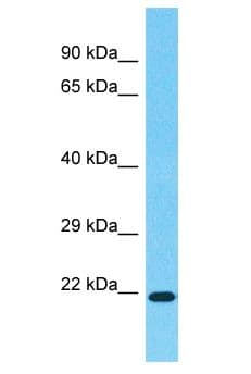 Polyclonal Rabbit anti-Human HOXA7 Antibody (aa174-223, WB)