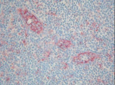 Alpha-1-Antichymotrypsin Antibody (clone ACT 14C7)