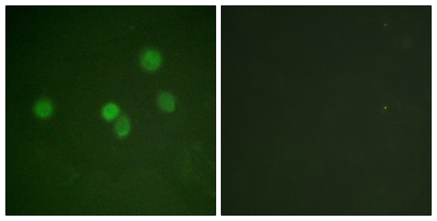 IHC-plus™ SP1 Antibody (aa421-470)