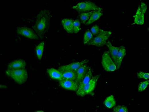 SKIL / SNO / SnoN Antibody