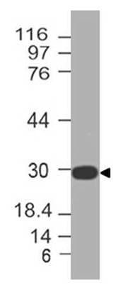 SOCS3 Antibody