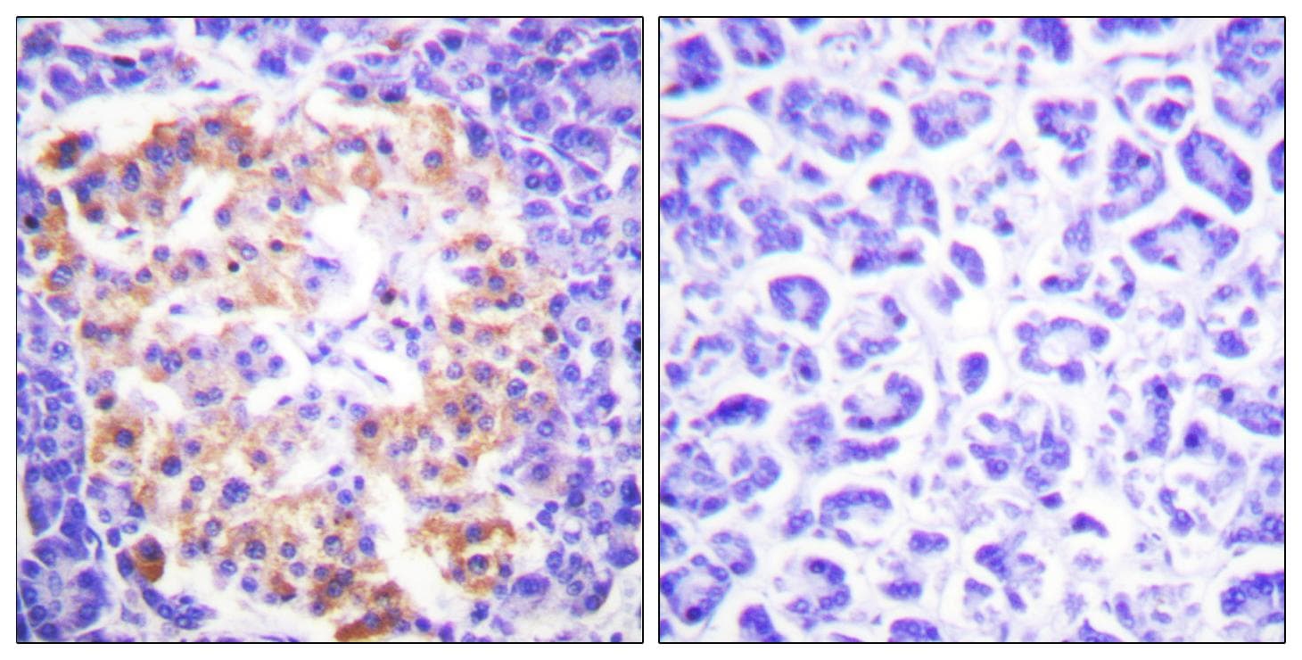 Collagen III Antibody