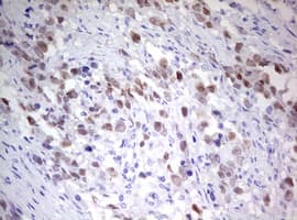 TIPIN Antibody (clone OTI1H4)