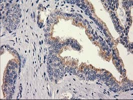 MEF2C Antibody (clone OTI1H5, Carrier-free)