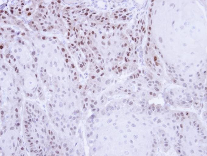 Polyclonal Rabbit anti-Human CSE1L Antibody (aa222-469, IHC, WB)