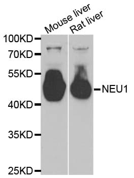 IHC-plus™ NEU1 / NEU Antibody
