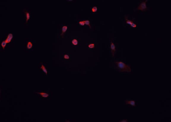 CCND1 / Cyclin D1 Antibody (phospho-Thr286)