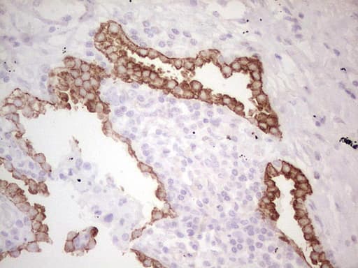 ABCB1 / MDR1 / P Glycoprotein Antibody (aa995-1280, clone OTI1A7)