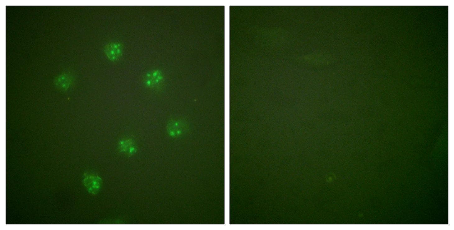 MKI67 / Ki67 Antibody