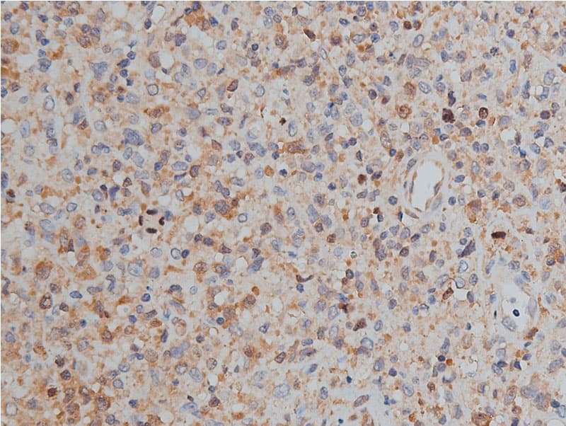 MKI67 / Ki67 Antibody