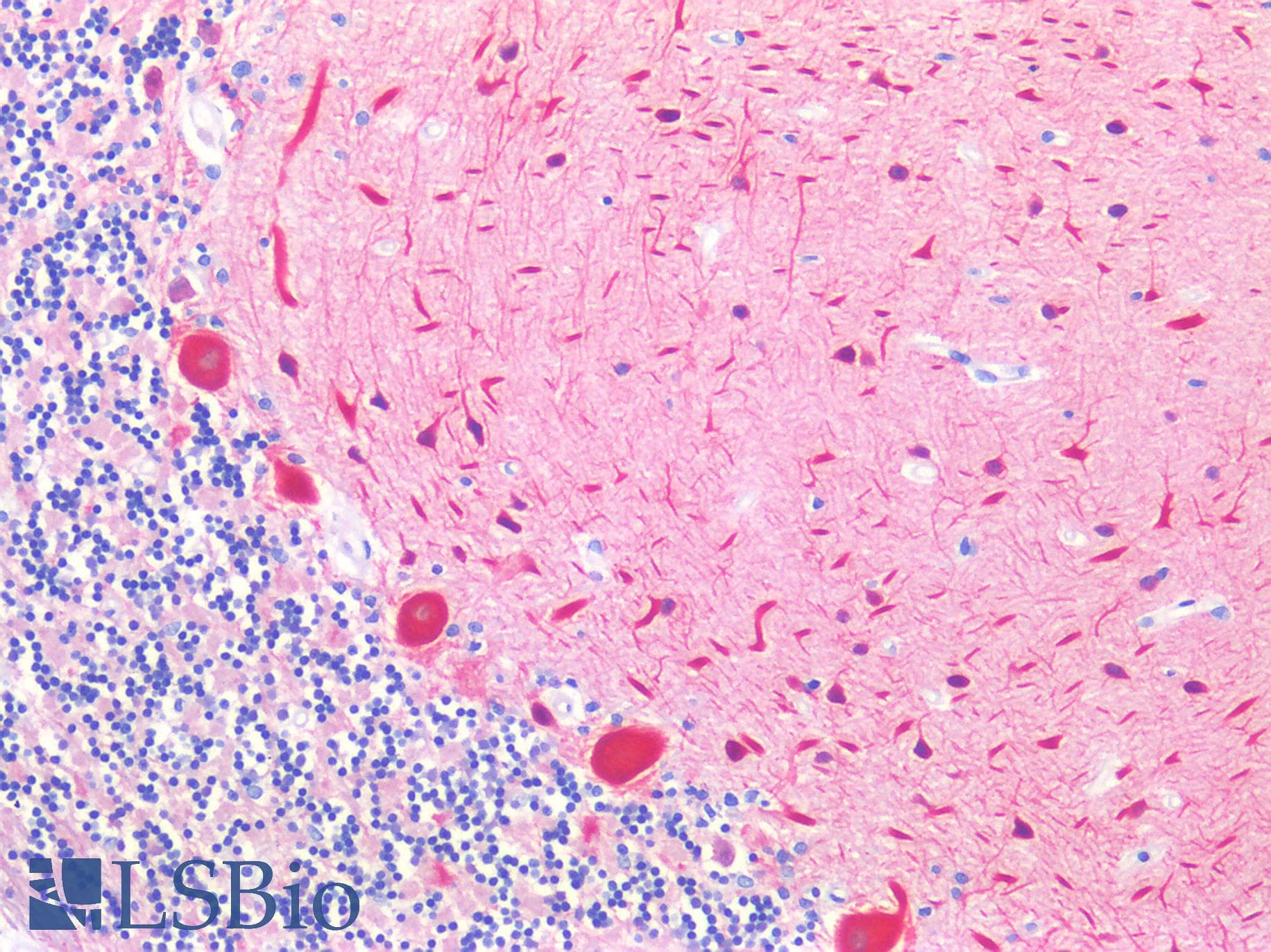IHC-plus™ TUBB3 / Tubulin Beta 3 Antibody