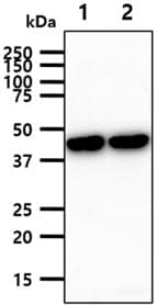 PathPlus™ Monoclonal Mouse anti-Human GLUL / Glutamine Synthetase Antibody (clone AT8D7, IHC, IF, WB)