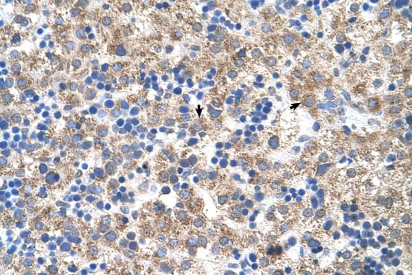 Polyclonal Rabbit anti-Human NR1I3 / CAR Antibody (N-Terminus, IHC, WB)