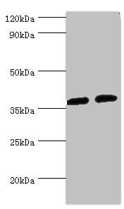 DDX / AKR1C3 Antibody (aa1-323)