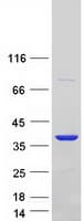 Human ANXA2 / Annexin A2 Protein (Recombinant Myc-DDK (Flag))