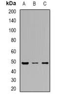 Polyclonal Rabbit anti-Human DDX39 Antibody (IHC, WB)