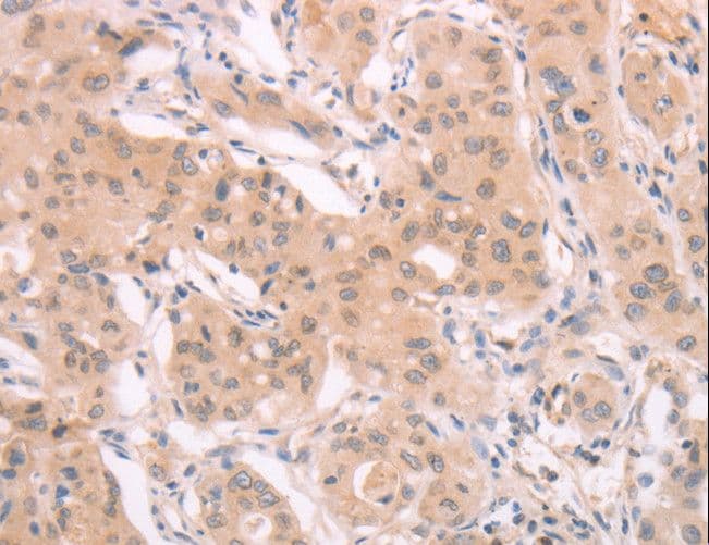 Polyclonal Rabbit anti-Human ADAM11 Antibody (IHC, WB)