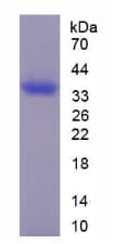 Chicken EPCAM Protein (Recombinant His-T7)
