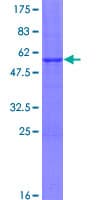 Human SSX3 Protein (Recombinant GST)