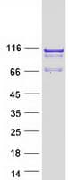 Human SPAG1 / TPIS Protein (Recombinant Myc-DDK (Flag))