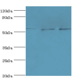 AMY2B Antibody (aa16-320)