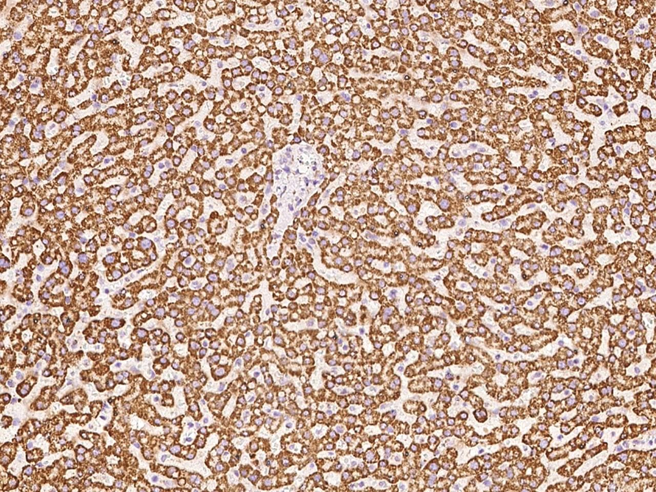 HSDL2 Antibody