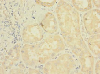 Polyclonal Rabbit anti-Human LRRC31 Antibody