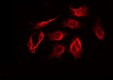 LFNG / Lunatic Fringe Antibody