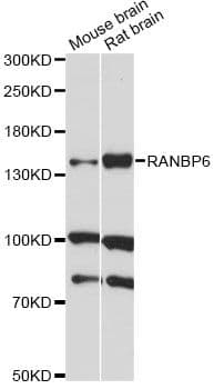 Polyclonal Rabbit anti-Human RANBP6 Antibody (WB)