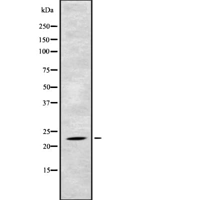 Polyclonal Rabbit anti-Human TAF10 Antibody (WB)